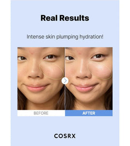 SÉRUM CON ÁCIDO HIALURONICO 3 SERUM COSRX